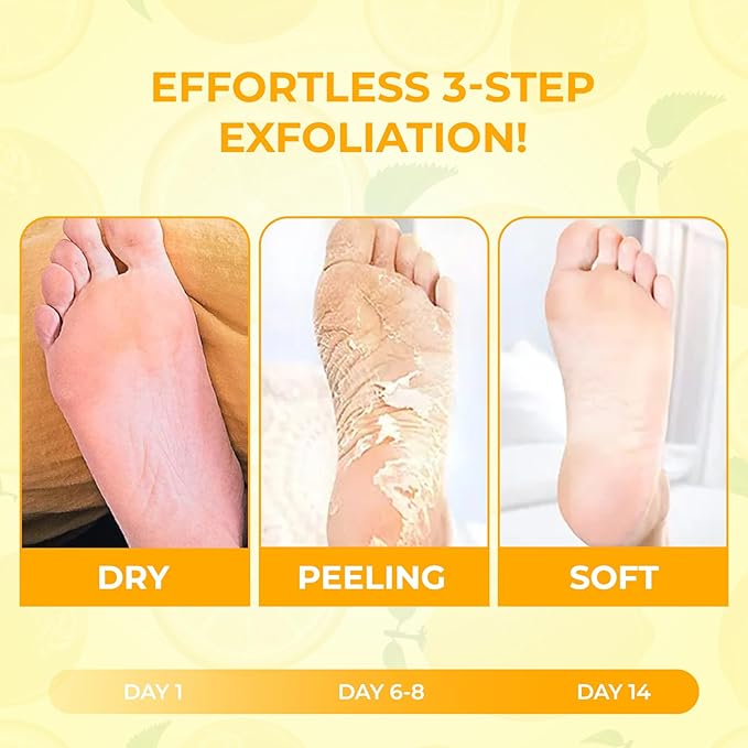 Happy Feet Lemon Exfoliating Foot Peel Mask – 3 Pack | Foot Peeling Mask for Dead Skin Removal, Smoother & Softer-Looking Feet, At-Home Foot Care Spa Treatment