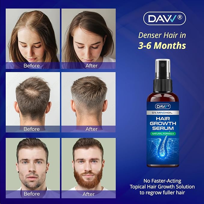 5% Minoxidil for Women and Men: 2-Pack Minoxidil Hair Growth Products - Minoxidil for Men - Biotin Serum - Hair Growth Serum with Rosemary - Hair Loss Solution - Faster Stronger Thicker - 60ML Each