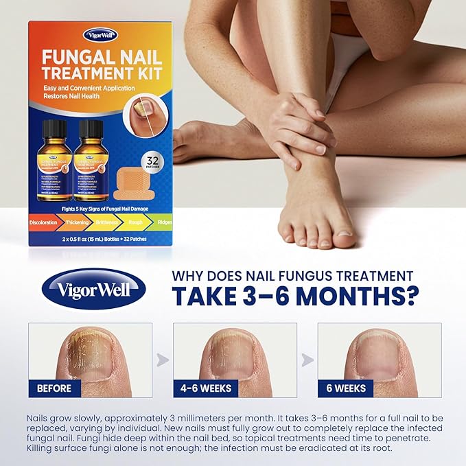 Toenail Treatment Extra Strength: Dual Action Nail Repair Kit for Thick, Brittle or Discolored Nails - 30 ml Nail Repair Gel with 25% Undecylenic Acid - (Medium) 32 Nail Patches