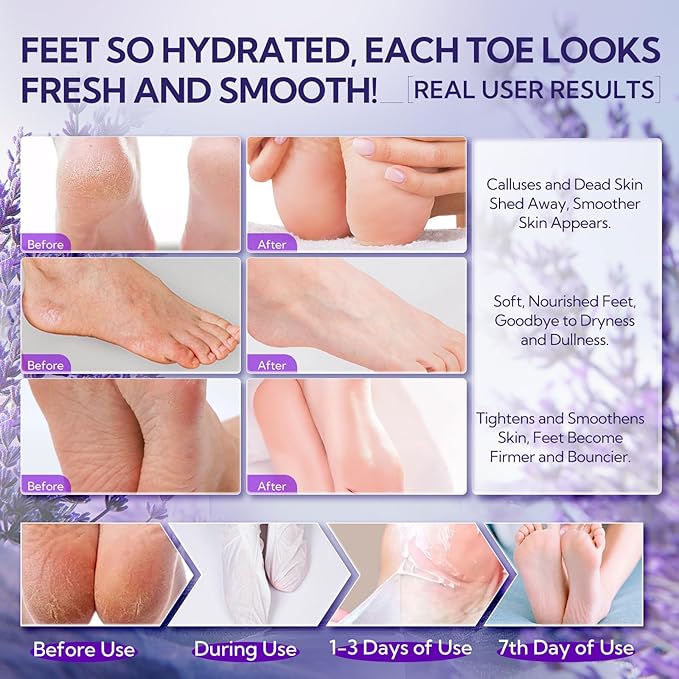 LANBENA Lavender + Vitamin C Foot Peel Mask（2 Pairs, Exfoliator Peel Off Calluses Dead Skin Callus Remover, Repairing Rough Heels for Men and Women, for Baby Soft & Smooth Feet