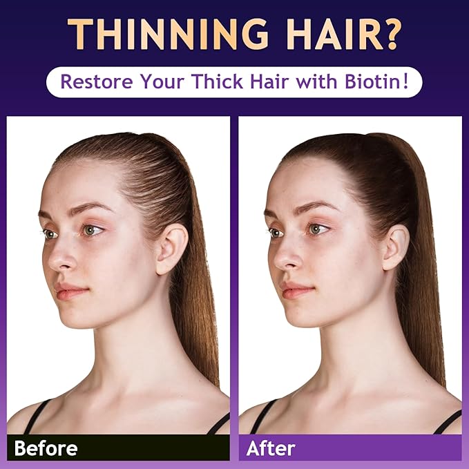Biotin Hair Growth Shampoo, Hair Loss Shampoo for Thinning Hair for Women & Men, Strengthen Roots, Control Oil & Thicken Thin Hair, Sulfate-Free for All Hair Types, 10.1 Fl Oz-Fresh
