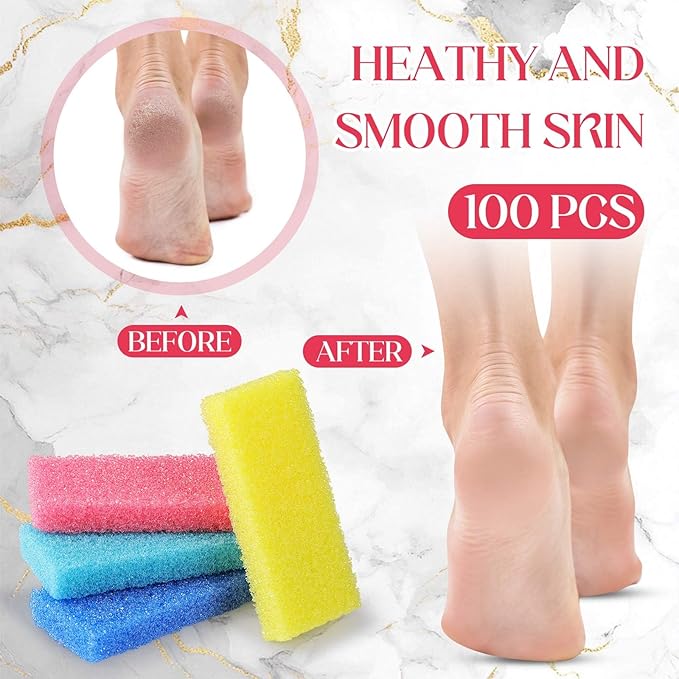 Batiyeer 100 Pcs Pumice Stone for Feet Scrubber Dead Skin Disposable Pedicure Pumice Stone Foot Shower Scrubber for Heel Cuticle Callus Remover Bath Spa(Blue, Sky Blue, Pink, Yellow)