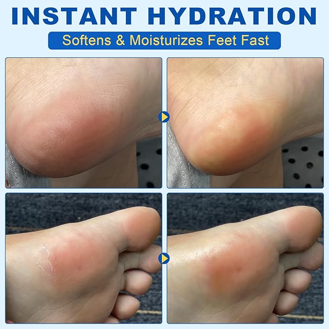 Bieyoc 60% Urea Cream with 2% Salicylic Acid, Urea Foot Cream Stick for Cracked Heels, Calluses and Rough Skin, Portable Foot Balm Stick No-Mess Applicator,1.41oz