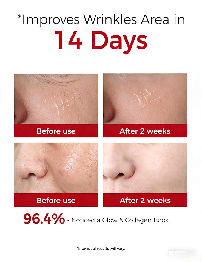 NING DERMOLOGIE Retinol Serum for Face: 300PPM Gentle for Sensitive Skin Beginners - Anti Aging & Wrinkle Peptides Serum I Collagen Booster for Night Firming & Hydrating Korean Skincare, 1.01 fl.oz