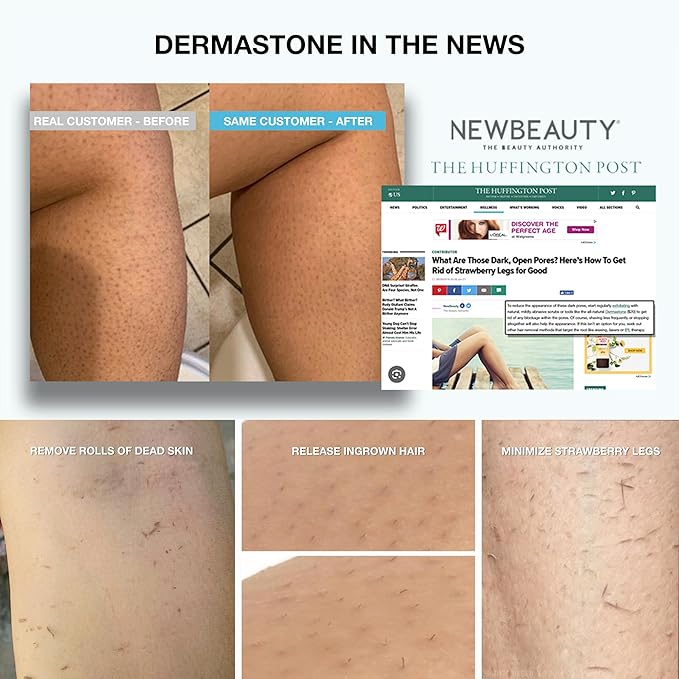 LEG & BODY SCRUB - Deep Exfoliating Stone Body Scrubber for Strawberry Legs Treatment, Leg Exfoliator Ingrown Hair, Dead Skin Remover, Foot Scrub & Natural Body Exfoliator for Women Men