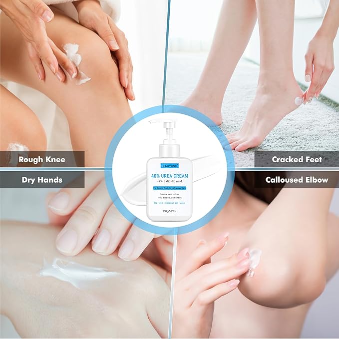 Urea Cream 40 Percent for Feet Maximum Strength, Urea Foot Cream Plus 2% Salicylic Acid, Tea Tree Oil, Coconut Oil and Aloe Essence for Feet Dry Cracked Heels Hands Elbows Knees