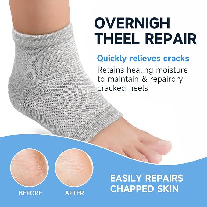 Heel Crack Care & Moisturizing Set, Includes a pair of moisturizing heel socks and a professional heel repair stick. deeply treats dry and cracked feet