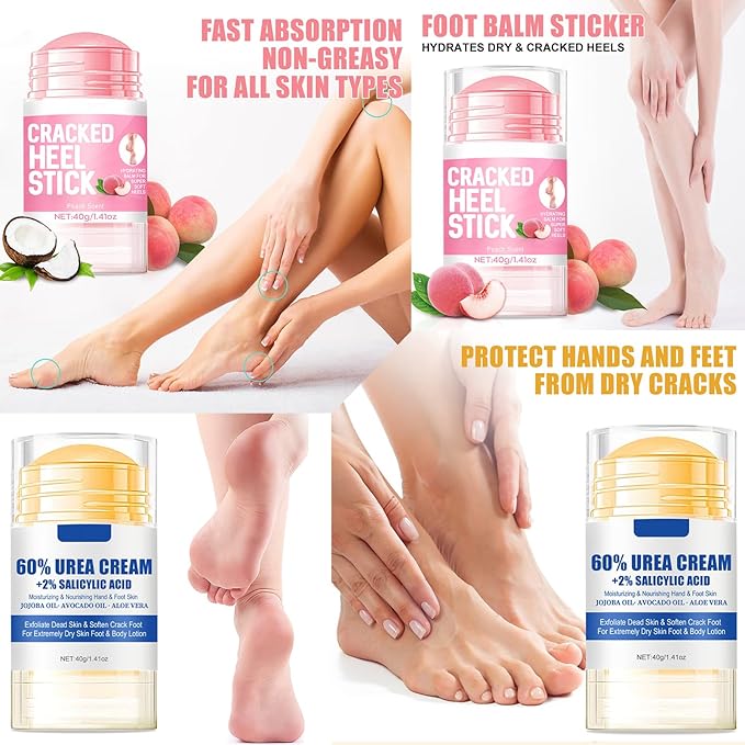 2pcs 60% Urea Hydrating and Anti-Cracking Foot Cream, Moisturising and Relieves Cracking and Dryness Foot Cream for Dry Cracked Feet And Hands（aloe + peach）