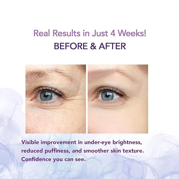 Caffeine Eye Cream for Under Eye Hydration (2 packs), Puffiness & Tired Looking Eyes –Lightweight Cooling Eye Balm with Caffeine, Peptides & Retinol –Daily Formula for Men & Women (15ml x 2)