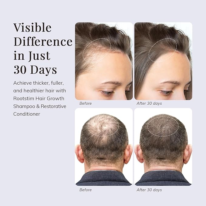 Hair Growth Shampoo and Conditioner Set - Rosemary & Biotin Shampoo and Conditioner for Hair Thickening - Botanical Boost for a Healthy Scalp, Hair Growth and Strengthen, 16.9 fl oz 2 Packs