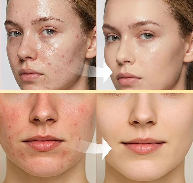 Pure 4% Niacinamide Serum for Acne Treatment for Face & Dark Spots | Brightening Face Serum with 1.5% Vitamin C | 1% Hyaluronic Acid | 1% Ceramide T5 | Made in China (4 fl.oz/120ml) Travel Pack Size