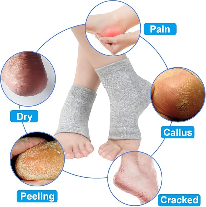 Vented Moisturizing Gel Heel Socks, 3 Pairs Toeless Spa Sock for Foot Care Treatment, Cracked Heels, Dry Feet, Foot Calluses (Grey)
