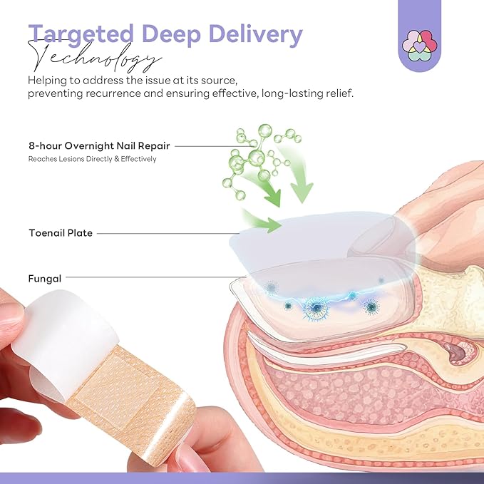 SAVILAND Extra Strength Fungal Nail Patches FSA-HSA: 96 Patch 8H Overnight Repair 1% Tolnaftate Toenail Treatment Nighttime Nail Renewal Restores Damaged Nails Discolored Thick Yellow
