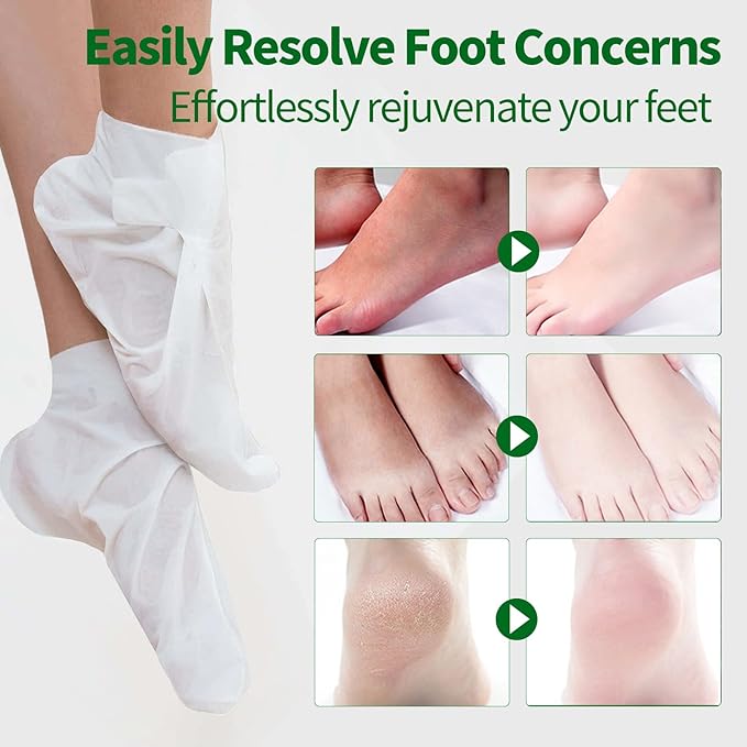 5 Pack Moisturizing Foot Mask,Hydrating Foot Masks for Dry Cracked Feet,Moisturizing Socks Dry Skin Moisturizer for Soft and Smooth Touch Feet,Foot Care Spa Gifts for Women Men Mothers Day Gifts