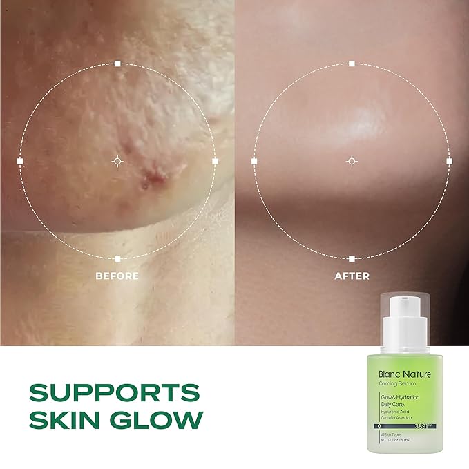 Calming Serum, Soothing and Hydrating Serum for All Skin Types with Hyaluronic Acid, Centella Asiatica and Panthenol, Korean Skincare for Glass Skin, 1.01 fl oz (30 ml)