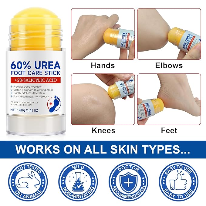 Urea Cream Stick, Maximum Strength Urea Foot Cream for Dry Cracked Feet, Knees, Hands, Exfoliating Dead Skin,Foot Care Cream Moisturizer 2 Pack