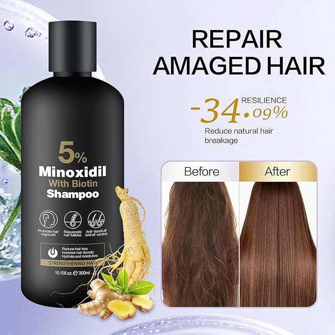 Minoxidil Shampoo & Conditioner Set for Hair Growth – Biotin, Ginseng & Ginger – Supports Thicker, Fuller Hair – Scalp Care Formula – For Men & Women – 600ml Duo