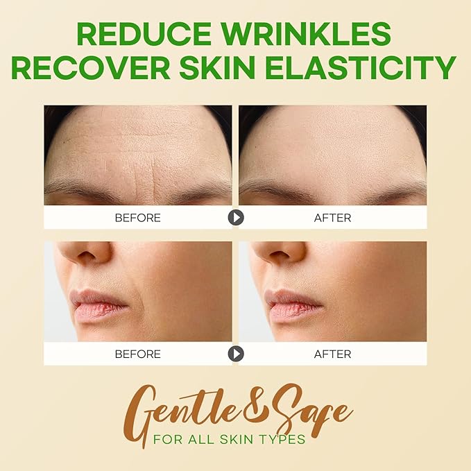 SILKDERMIS Forehead Wrinkle Patches 12Pcs, Smile Line Patches 24pcs with Aloe, Collagen, Vitamin E, Anti Wrinkle Patches, Anti Wrinkle Patches