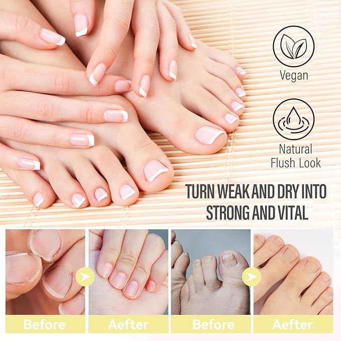 CHUCHU Vegan Cuticle Oil for Nails: Tea Tree Jojoba Nail Cuticle Oil with Vitamin B & E for Moisturizes Cuticle and Nail's Skin - Prevents Hangnails and Chapped 15ML