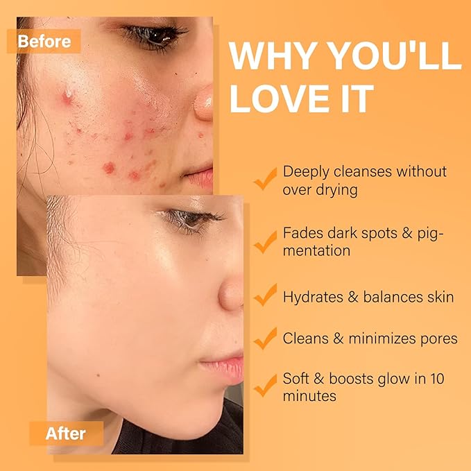 Facial Clay Mask Set - Vitamin C Turmeric Face Mask, Dead Sea Mud & Salicylic Acid (BHA) Mask for Pore Cleansing, Brightening, Blackheads & Dark Spots, Face Masks Skincare Gift for Women, 2.82 oz each
