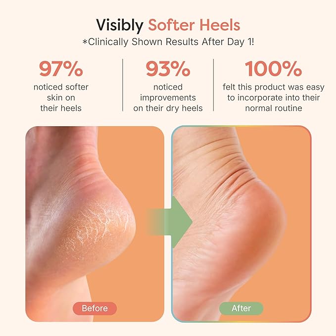 ZenToes Moisturizing Socks for Cracked Heel Treatment, Vitamin E, Olive Oil and Jojoba Oil Infused Heel Socks, Spa Gifts for Women, Mothers Day Gifts (Fuzzy Blue and Pink, Regular)