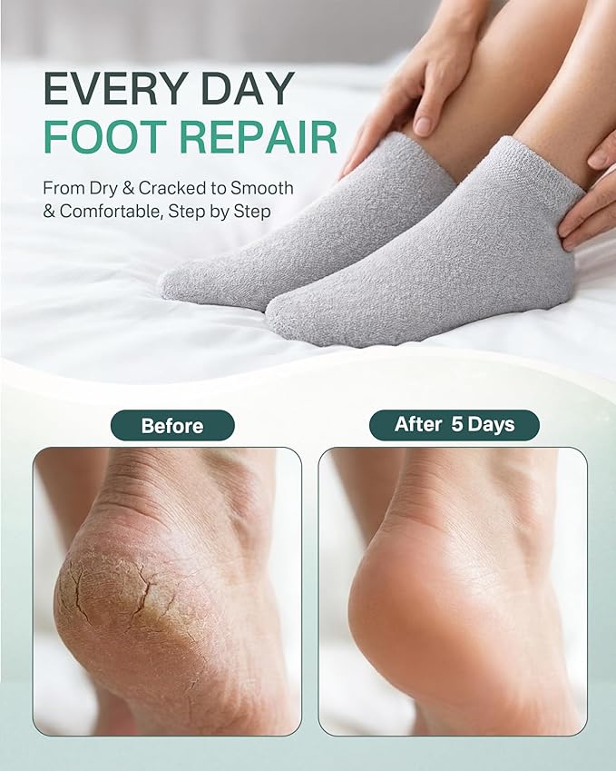 Moisturizing Socks for Dry Cracked Feet, Silicone Socks for Foot Spa(up to Size 8.5), Gel Socks for Foot Care Overnight, Aloe Socks Heel Protector for Cracked Heel Treatment, Self Care Gifts for Women