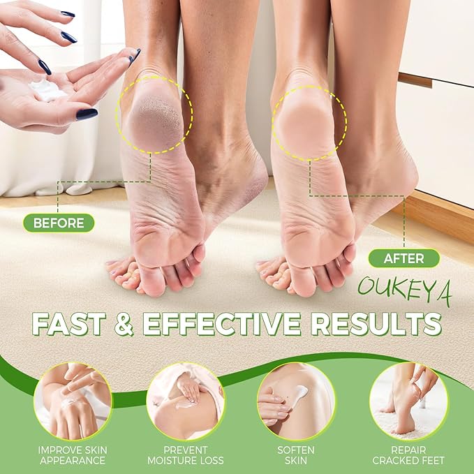 OUKEYA 40 Percent Urea Foot Cream,with Salicylic Acid,Tea Tree Oi & Ceramides,Cracked Heel Smooth | Dry Skin Exfoliator | Nourishes | For Foot,Hands, Elbows, Knees