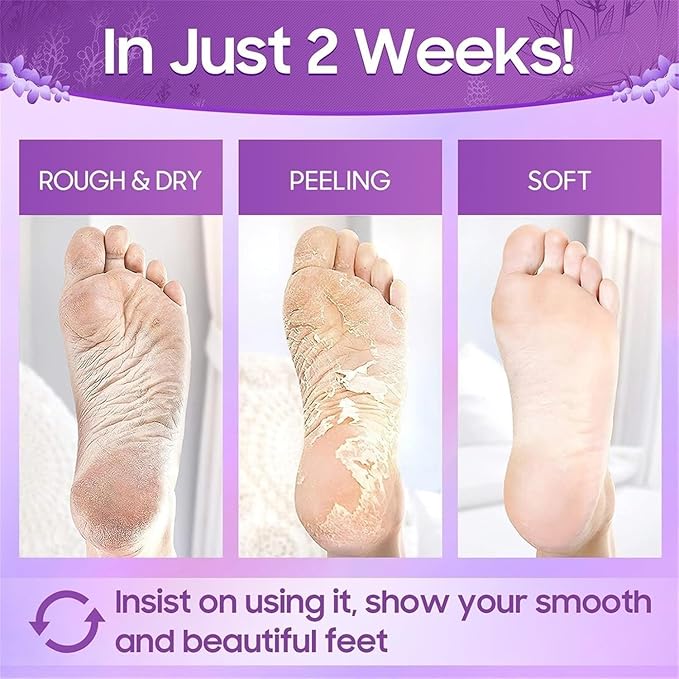 Foot Peel Mask for Women & Men | Peeling & Exfoliating Foot Mask for Dry Cracked Feet, Removes Dead Skin & Calluses, Hydrates & Smooths Cracked Heels (Standerd, Lavender)