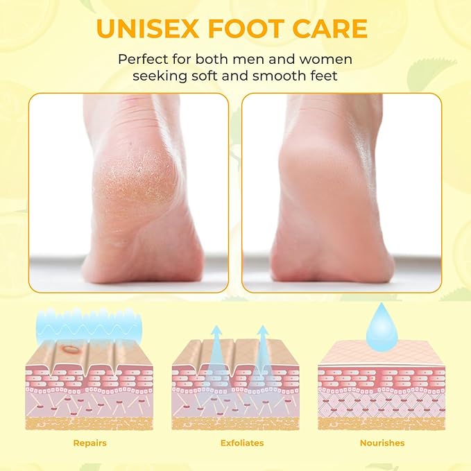 Happy Feet Lemon Exfoliating Foot Peel Mask – 3 Pack | Foot Peeling Mask for Dead Skin Removal, Smoother & Softer-Looking Feet, At-Home Foot Care Spa Treatment