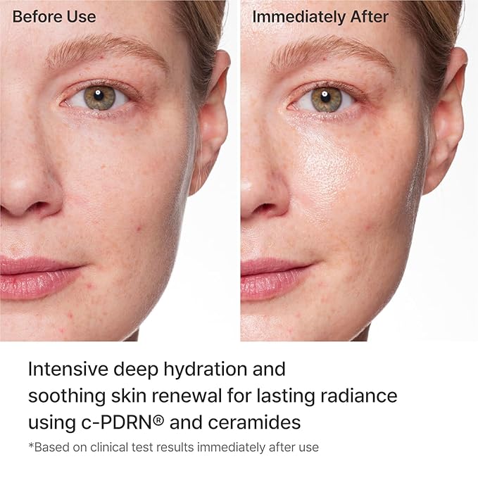 REJURAN® Turnover Mask, c-PDRN® (5ea) – Original Salmon DNA for Firming, Hydration, Repairing & Revitalizing. Achieve Youthful, Radiant Skin. Korean Skincare. Ultra Microfiber Sheet Mask