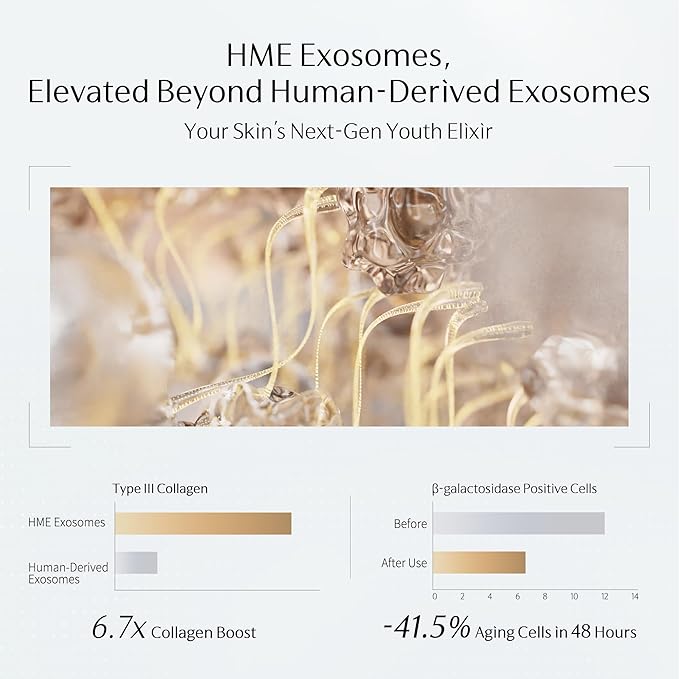 EMS Eye Cream for Puffiness Bag Under Eye | Exosome & PDRN Vibrating Eye Tightener Cream for Dark Circle | NAD+, Caffeine, Peptide, Collagen |for Firming,Reducing Wrinkle(0.88 oz/25g)-2 Pack