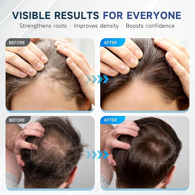 Hair Growth Shampoo with Biotin & Rosemary for Thinning Hair for Women, Anti Hair Loss Shampoo, Natural Thickening Formula, Sulfate Free with Comb, 11.84 fl oz