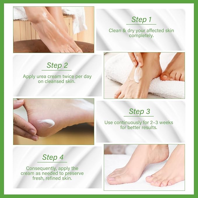 Urea Cream 60 Percent for Feet Maximum Strength, Foot Cream for Dry Cracked Heels and Feet, Foot Moisturizer, 5.29oz/150g