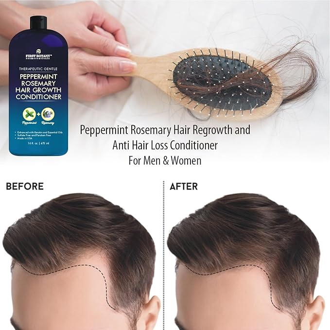 Peppermint Rosemary Hair Regrowth Conditioner - Anti Hair Loss product, Daily Hydrating, Detoxifying, Volumizing Conditioner and Fights Dandruff For Men and Women 16 fl oz