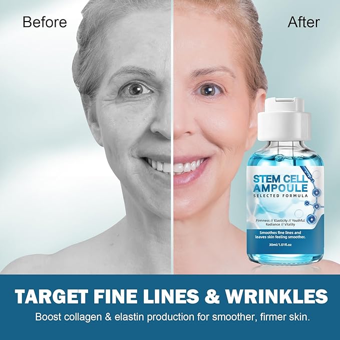 Stem Cell Serum for Face – 2 Pcs Microneedling Serum Ampoule Booster to Use with and without Derma Pen, Korean Anti-Aging Skin Care for Wrinkles, Scars, Hydration & Rejuvenated Skin 1 fl.oz