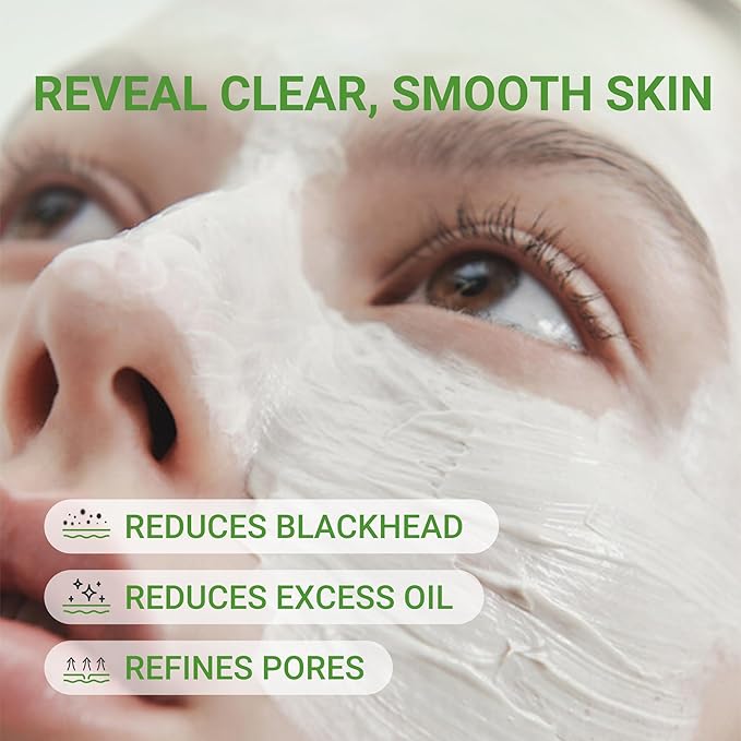 3X Acid Clay Mask with Amazonian White & Glacier Clay, Deep Cleansing Facial Skincare for Pore Minimizing Oil Control & Detox, Face Mask for All Skin Types, 3.53 oz