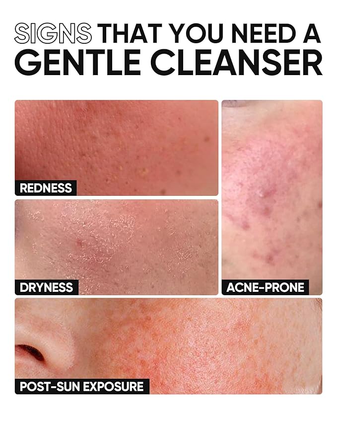 SKINTIFIC 5X Ceramide Low pH Facial Cleanser, Gentle Hydrating Face Wash with Hyaluronic Acid, Daily Face Wash for Dry to Normal Skin, Sensitive Skin Tested, Not Tight, Fragrance Free