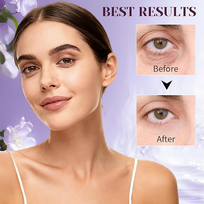 5-in-1 Caffeine Eye Cream for Dark Circles & Puffiness–with Caffeine, Collagen, Niacinamide, Retinol & Hyaluronic Acid–Anti-Aging, Firming, Hydrating & Revitalizing Eye Cream for Men & Women, 0.5 oz