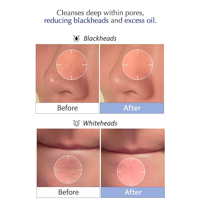MSM Sulfur Deep Pore Cleanser – Low pH Barrier-Respecting Face Wash, Pore Reset for Sensitive Skin