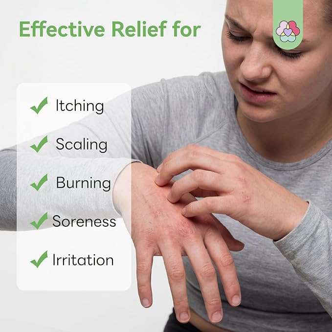SAVILAND Antifungal Cream 120g Extra Strength: Max 25% Undecylenic Acid Fungal Cream for Skin Athletes Foot Jock Itch Ringworm Foot Fungus Treatment Natural Skin Relief with Tea Tree & Oregano Oil