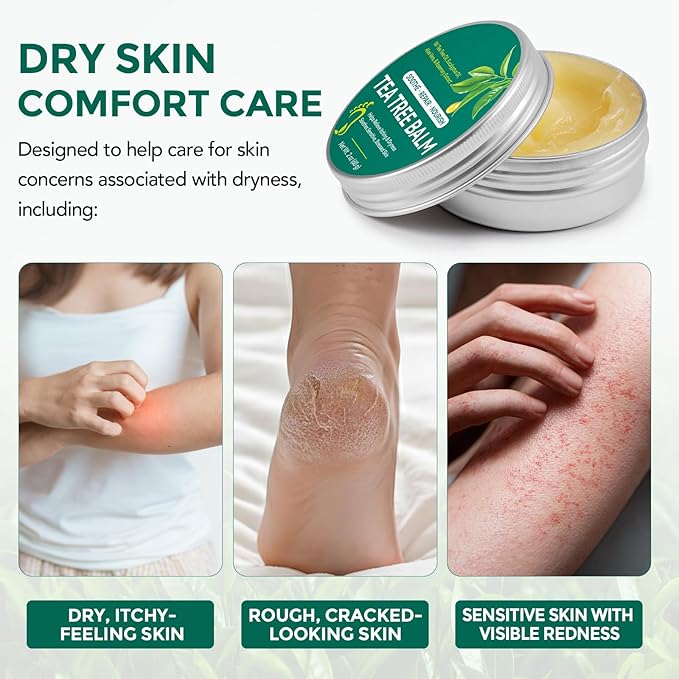 Tea Tree Balm for Dry Itchy Skin, Natural Tea Tree Oil Salve for Cracked Heels, Feet, Hands & Body, Moisturizing Herbal Skin Repair Balm with Aloe Vera, Eucalyptus, Green Tea & Vitamin E, 2 oz