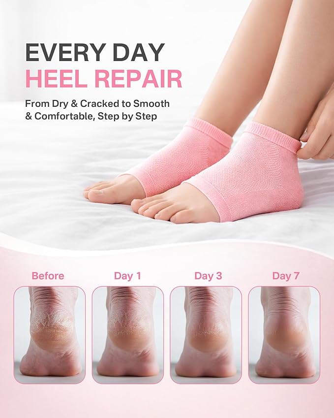 Moisturizing Socks, 100% Cotton Heel Socks for Dry Cracked Feet Women, Cracked Heel Treatment Silicone Heel Socks, Breathable Hydrating Gel Heel Protectors for Repair, Spa & Daily Use, 2 Pairs, Pink