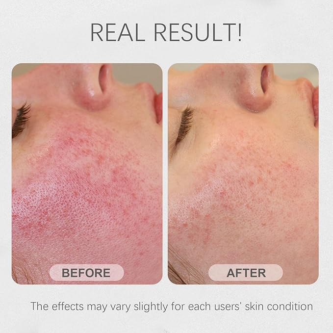 Rice Face Mask, Gentle Exfoliating Wash Off Facial Mask for Dull, Rough Skin, Pore Clearing, Remove Dead Skin Cells for All Skin Types 3.53 Fl Oz