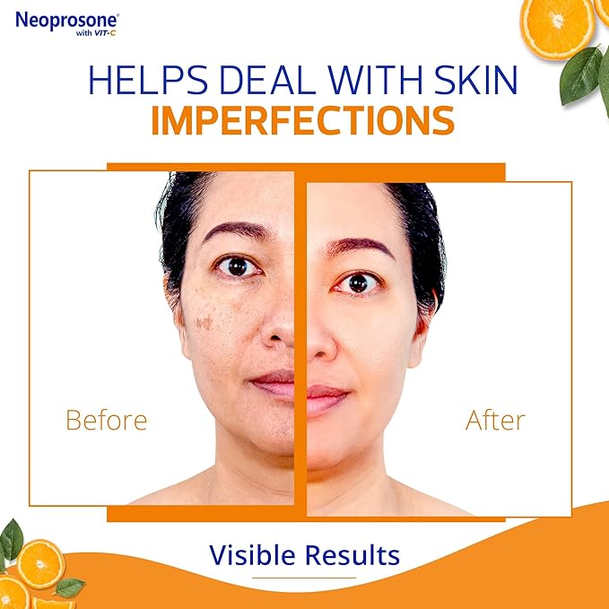 NEOPROSONE 20% Vitamin C Dark Spot Corrector Cream - 1 Fl oz / 30ml - Skin Brightening Gel Cream - with Hyaluronic Acid, Vitamin E