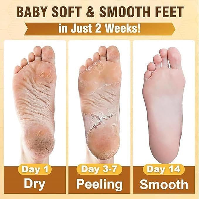 Goat Milk Foot Peel Mask (6 Pack), Exfoliating Foot Mask for Dry Cracked Feet, Dead Skin Callus Remover, Foot Exfoliator for Baby Soft Feet (Goat Milk)