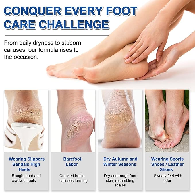NovaCharm 2PCS Urea Cream 60 Percent for Feet, Maximum Strength Urea Foot Cream Stick, Foot Moisturizer Lotion for Cracked Heels, Dry Hands & Rough Knees (1.4Ounce(Pack of 2), Aloe Vera)