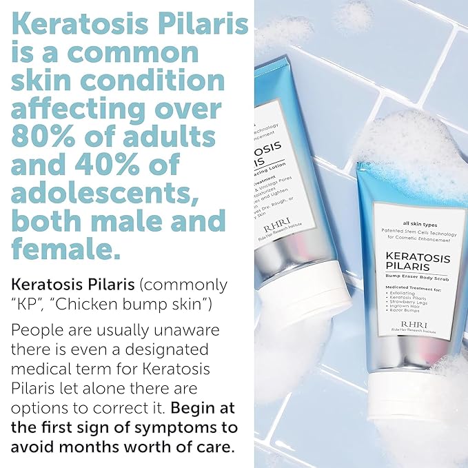 KP Bump Eraser Body Set & Antifungal Soap | Keratosis Pilaris Treatment, Exfoliating Body Scrub, Lotion & Ingrown Hair Care | Medicated Jock Itch, Ringworm & Athlete’s Foot Relief