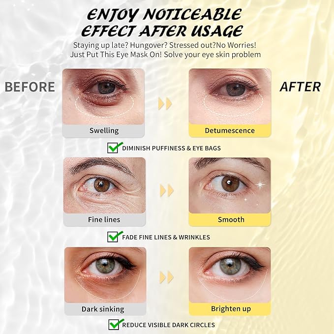 Maskiss Under Eye Patches (8 Pairs), Hyaluronic Acid Eye Masks for Dark Circles Puffy Eyes Undereye Bags, Collagen Eye Patches for Wrinkles and Hydrate, Skin Care Gift for Her
