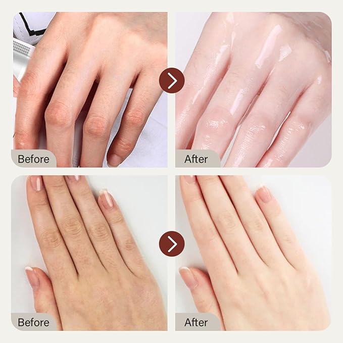 ARCHIDATE Retinol Hand Cream for Aging Hands, Hydrating Hand Cream for Dry Cracked Hands, Smooths Fine Lines & Wrinkles, Soft Smooth Skin, Intense Moisture, Non-Greasy, Fast-Absorbing