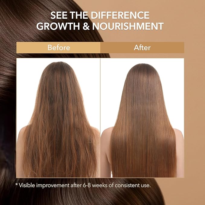 Biotin Hair Growth Shampoo for Thinning Hair in Adults 30+ – Strengthening Formula with Biotin & Rosemary – Reduces Shedding, Supports Fuller, Stronger Hair – Sulfate-Free, 16.9 fl oz